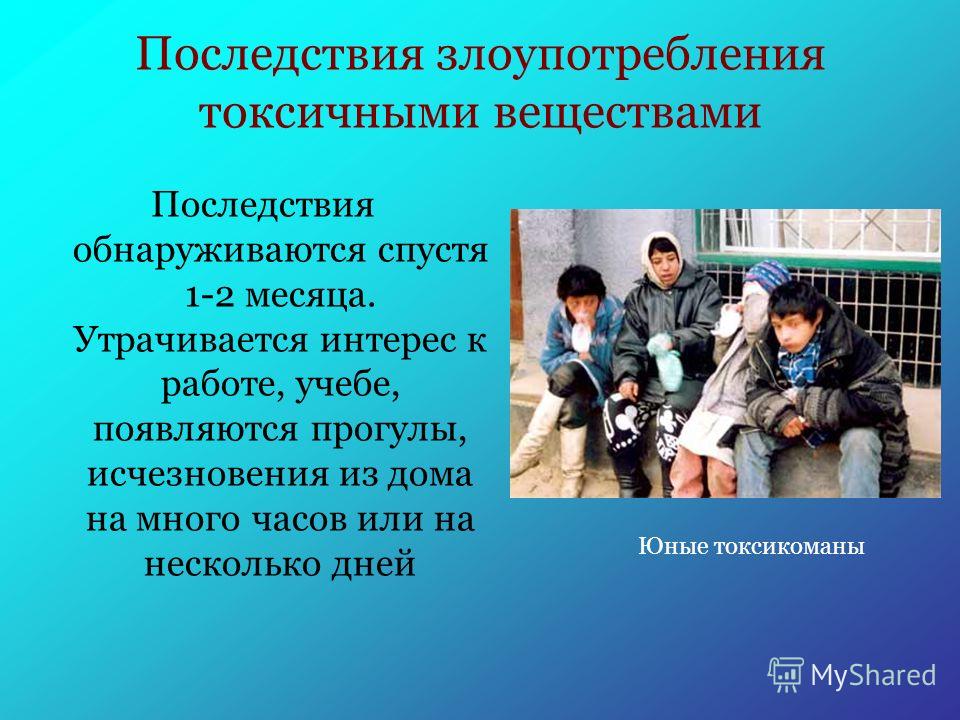 Ноотропы для улучшения работы мозга